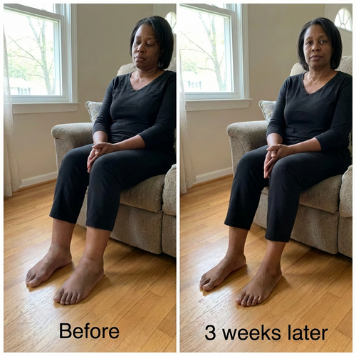 Rhodiola Rosea – Natural Cortisol Support